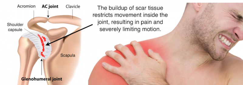 refacerea cartilajului medicației articulației genunchiului